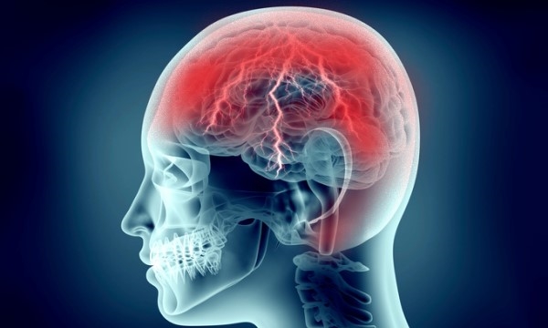 Ból głowy u góry czaszki - przyczyny, źródła i leczenie bólów czaszki